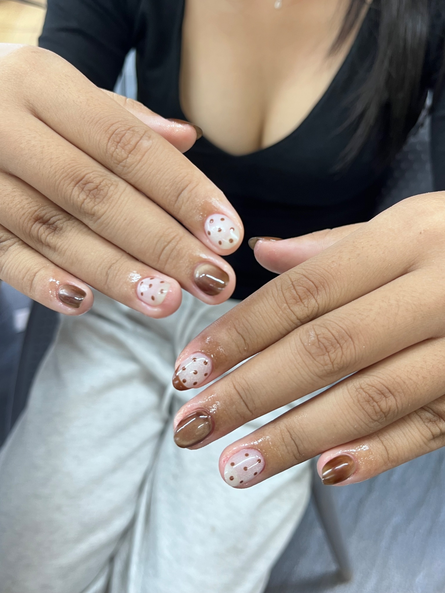 Xử lý các dạng móng cụp vểnh, lệch trục